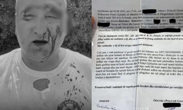 Dhunohet operatori i një guide turistike polake në Përmet: Më rrahu konkurrenti! E ka nga xhelozia