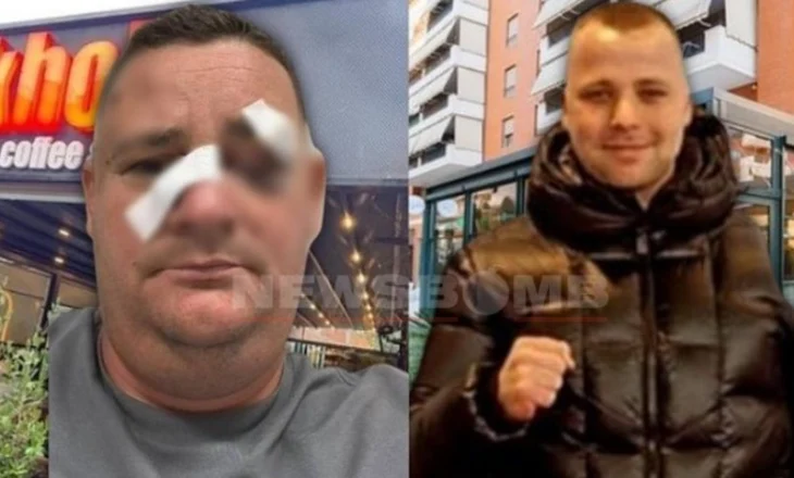Merr fund arratia e pronarit të “Stockholm”! Kush është Ferhat Kraja, biznesmeni që dhunoi kundërshtarin e tij