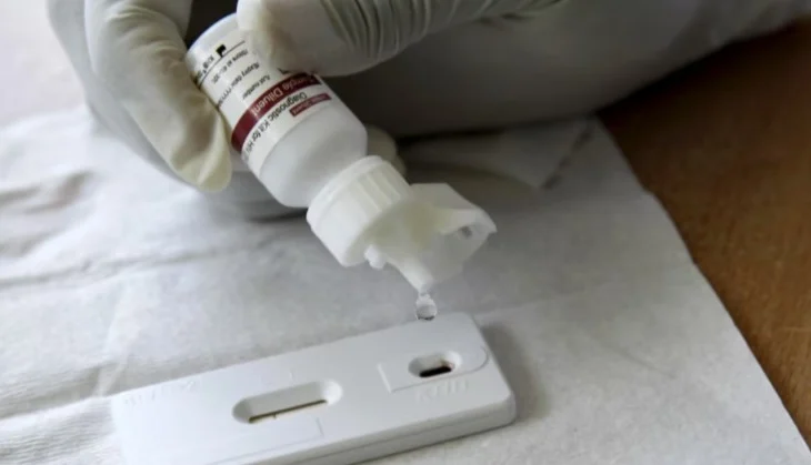 Ndërron jetë një person nga AIDS, 19 raste të reja me HIV këtë vit