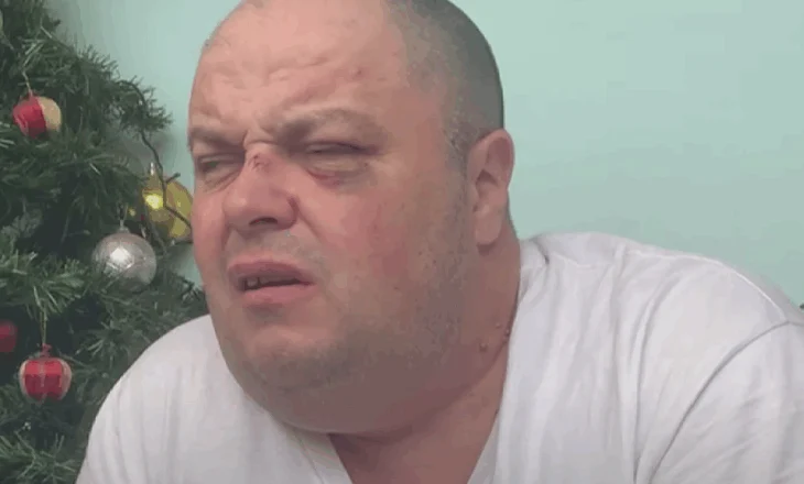 Personazhi i Tiktok, Genard Hajdini rrëfen dhunën: Më goditi disa herë, për 7 sekonda…