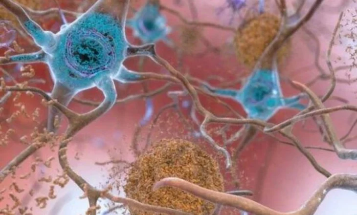 Studimi i Harvardit arrin të zhdukë simptomat e Alzheimerit për herë të parë tek minjtë