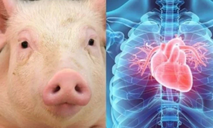 Sukses në Kinë, transplantohet për herë të parë mushkëria e derrit te njeriu