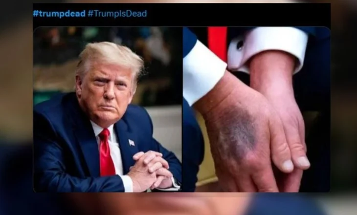 “Trump ka vdekur”, spekulimi që u përhap me shpejtësi në rrjet. Çfarë ndikoi?