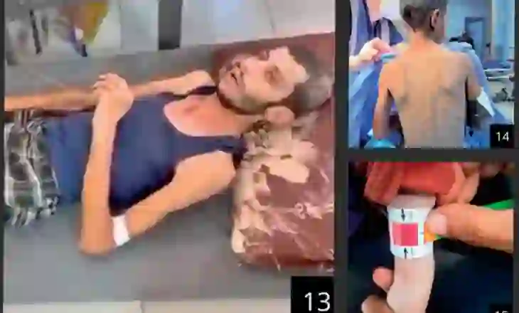 “Uria në çdo cep”, pamjet nga brenda spitaleve të Gazës që po tmerrojnë botën