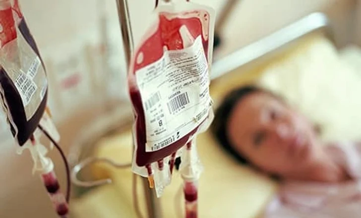 25% e grave nga 15 deri 49 vjeç në Shqipëri vuajnë nga anemia, përkeqësim në dekadën e fundit