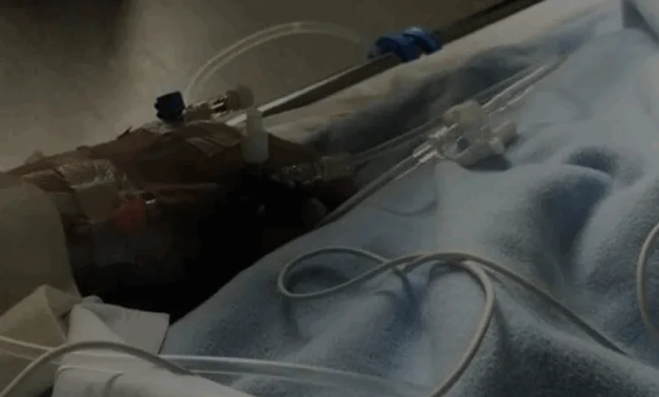 Familjarët kërkojnë ndihmë për kurimin e kamarieres së plagosur në atentatin e Shkodrës: S’i përballojmë dot faturat