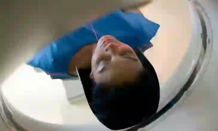 Gratë që bëjnë skanime CT përpara shtatzënisë, rrezikojnë aborte ose foshnje me defekte të lindjes