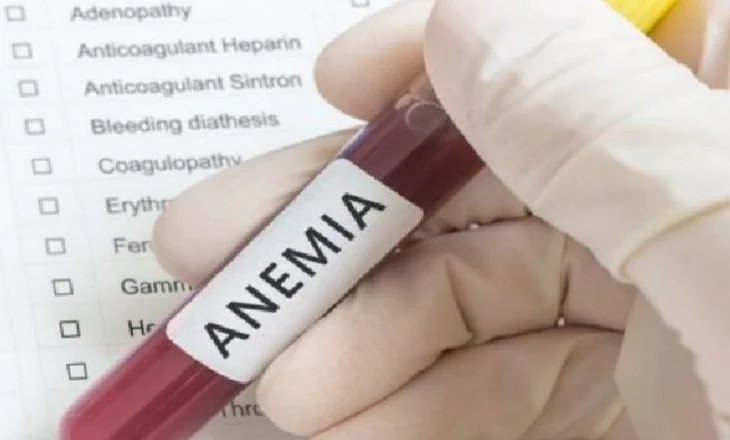 Rastet e anemisë te gratë shqiptarë në rritje, ja si të mbroheni sipas ISHP