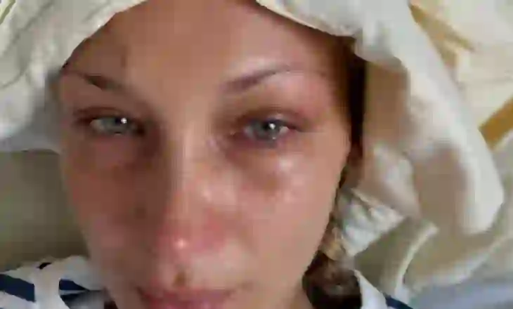 Bella Hadid: Ju që luftoni çdo ditë me ankthin, nuk jeni vetëm