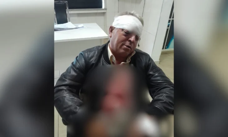 Dhunuan barbarisht punonjësin e pastrimit në Vlorë, arrestohen dy autorët (Emrat)