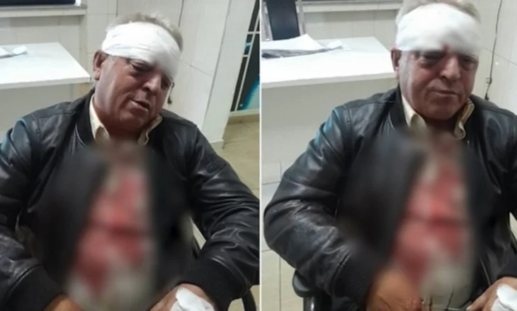 E rëndë! Dhunohet barbarisht punonjësi i pastrimit në Vlorë, dy persona i zunë pritë me furgon