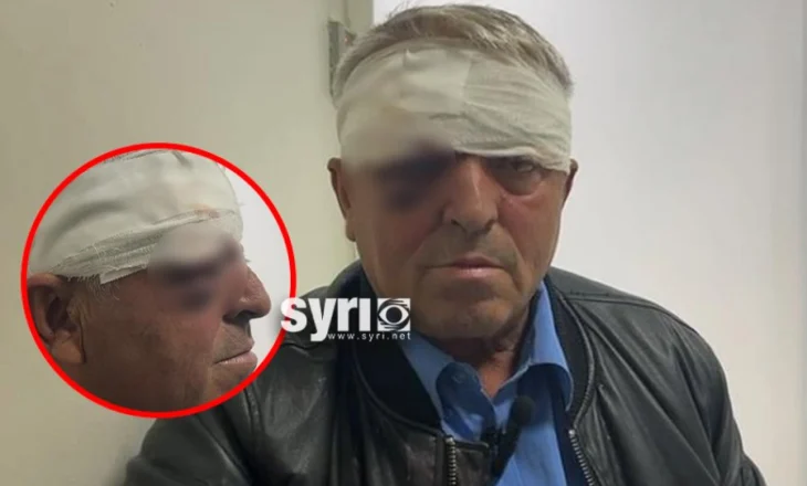 EMRAT/ Dhunuan 61-vjeçarin në Vlorë, arrestohen dy autorët me precedentë penalë