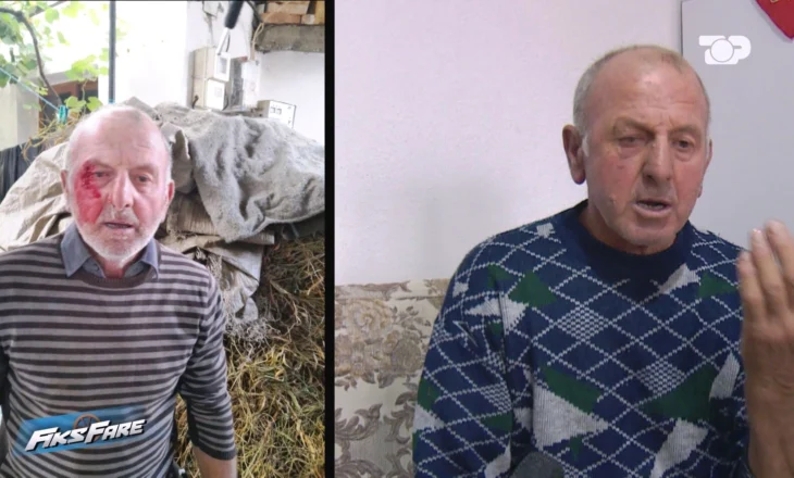 Fiks Fare/ Dhunohet familja në Devoll, policia lë të lirë autorin. Mjeku ligjor vonon ekspertimin
