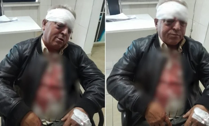 “Goditi furgonin me biçikletë”/ Zbardhet dëshmia e dy autorëve që dhunuan punonjësin e pastrimit