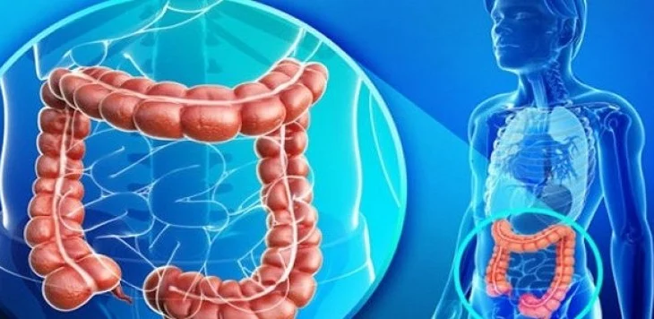 ‘Kujdes me ushqimet krudo’/ Mjeku tregon arsyet që shkaktojnë gastroenterit