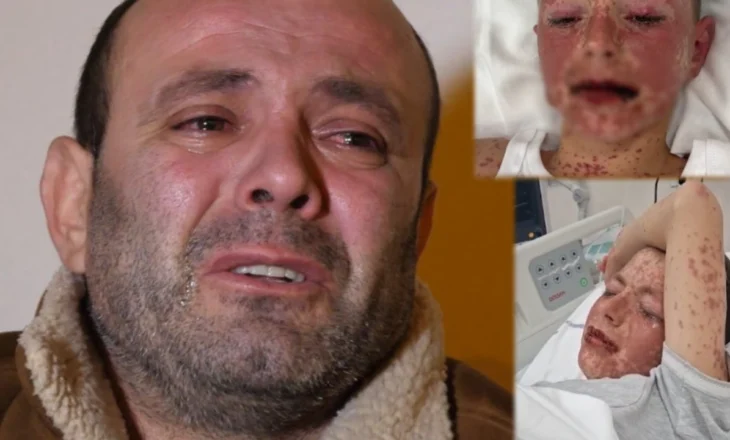 “Më mirë të jem i vdekur sesa të shoh tim bir kështu”/ Sëmundja e rrallë ka prekur 12-vjeçarin, familja dhe shokët e klasës bëjnë apel për ndihmë në “Për Shqiptarët”