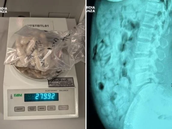 Nga tregtare veshjesh në trafikante! Çfarë i gjetën në stomak 46-vjeçares në aeroportin e Italisë