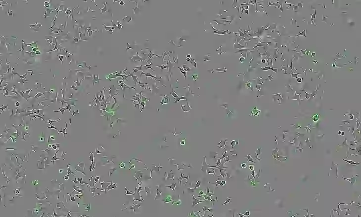Një proteinë e veçantë që gjendet në baktere, mund të shkaktojë vetë-shkatërrimin e qelizave kancerogjene