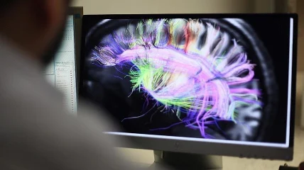 OBSH: Shumica e vendeve nuk kanë politika për të trajtuar çrregullimet neurologjike