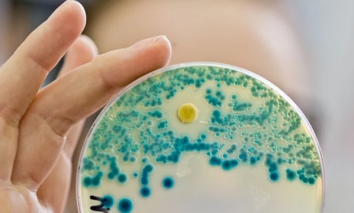 Rezistenca e baktereve ndaj antibiotikëve po rritet. Çfarë mund të bëni?