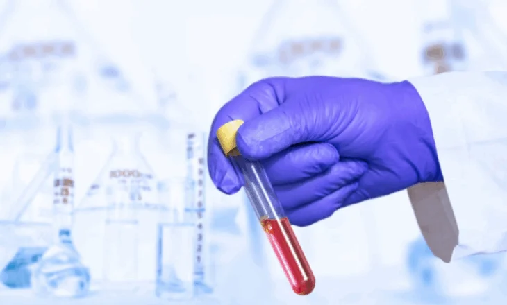 Test revolucionar i gjakut që zbulon kancerin në fazë të hershme, premton ndryshim rrënjësor në diagnostikim