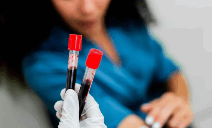 Testi që zbulon 50 lloje kanceri! Rezultate befasuese në SHBA, mund të ndihmojë në diagnostikimin e hershëm të sëmundjes