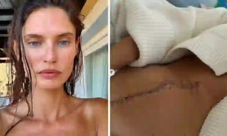 Victoria’s Secret e refuzoi sepse ka kancer: letra prekëse e Bianca Balti që tronditi botën e modës