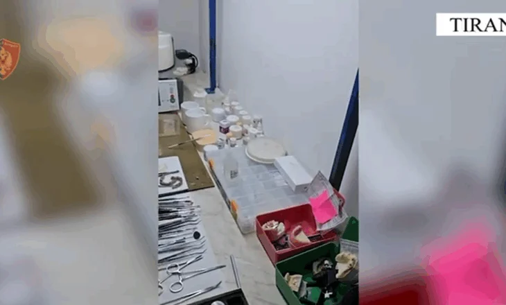 VIDEO/ 100 mijë euro produkte të skaduara në klinikën dentare, arrestohet administratori i “Dental Turk” (EMRI)
