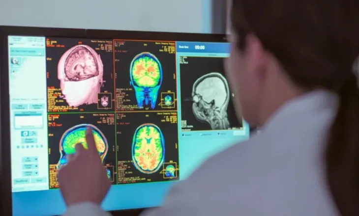 Adoleshenca zgjat deri në të 30-at, studimi i ri identifikon katër mosha kyçe të zhvillimit të trurit