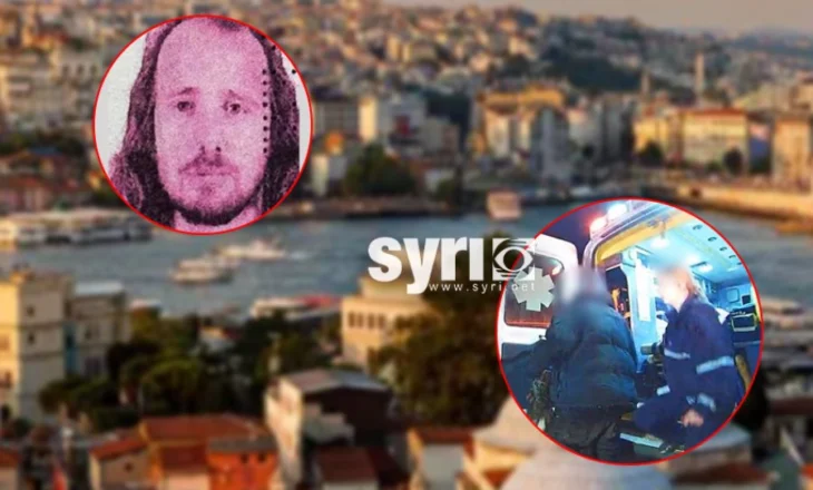 Bëri transplant të flokëve dhe trajtim dentar, humb jetën 36-vjeçari shqiptar në Turqi