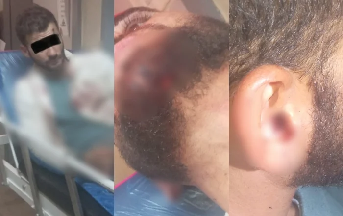 Denoncimi/ Policia greke dhunon të riun shqiptar, ndodhet në gjendje të rëndë në spital