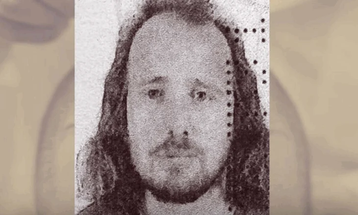 EMRI / Shkoi që të mbillte flokët në Turqi, vdes pas transplantit shqiptari