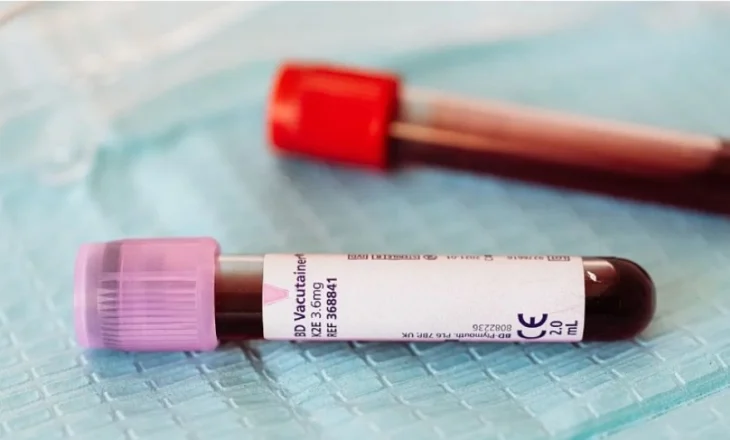 Etiopia konfirmon tre viktima nga virusi vdekjeprurës Marburg