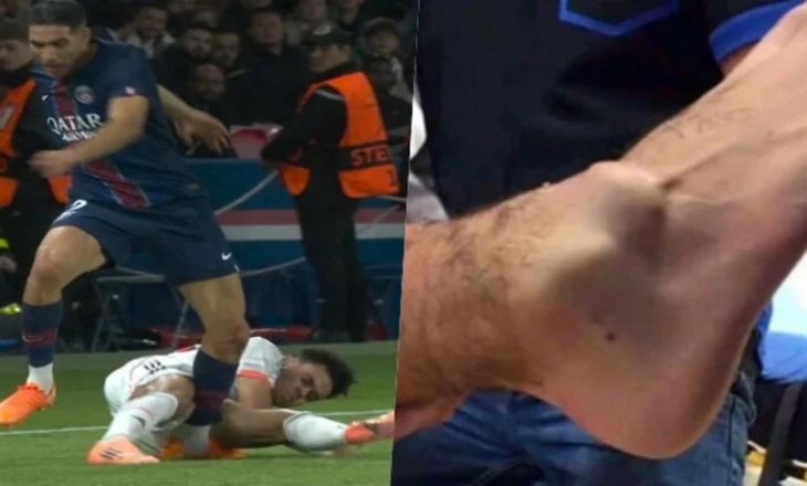 Hakimi, pamje tronditëse e kyçit të këmbës pas ndërhyrjes brutale të Luis Díaz