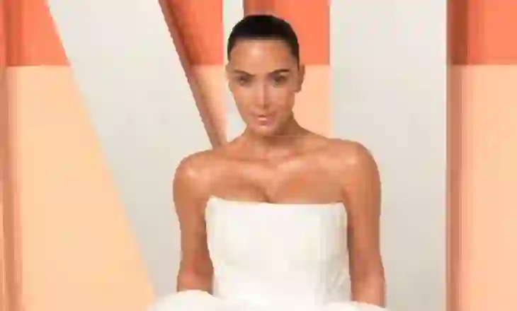 Kim Kardashian flet për diagnozën e aneurizmit në tru: Kam katër fëmijë që varen nga unë