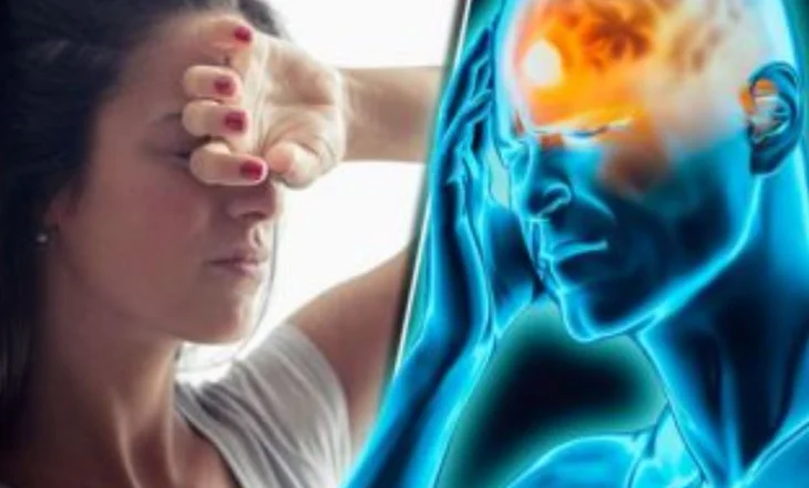 Migrena dhe dhimbjet e kokës përbëjnë ‘sfidë globale’ për shëndetin publik, çfarë sugjerojnë ekspertët