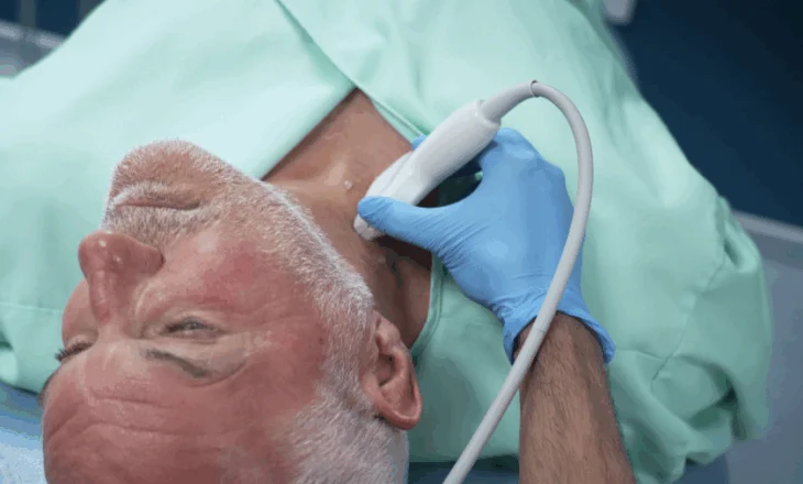 Një skanim i thjeshtë i qafës mund të zbulojë meshkujt me rrezik të lartë për probleme me zemrën