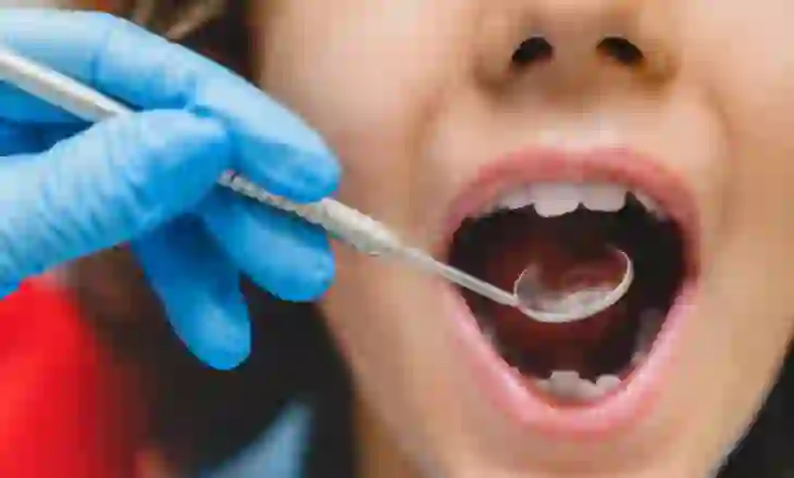 OBSH: Gjysma e fëmijëve shqiptarë i kanë dhëmbët të prishur/ Raporti tregon edhe shkaktarët