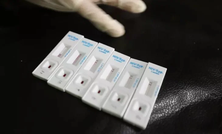 OBSH jep alarmin: Gjysma e diagnozave të HIV në Europë zbulohen shumë vonë