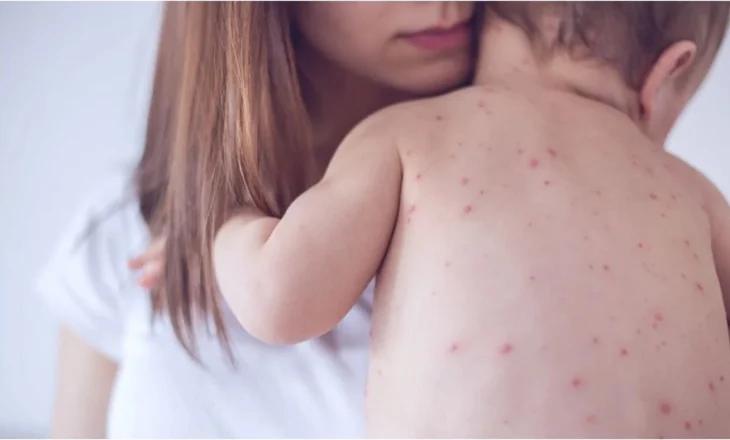 OBSH: Rastet e fruthit u rritën me 47% në Evropë dhe Azinë Qendrore vitin e kaluar, ja shkaqet