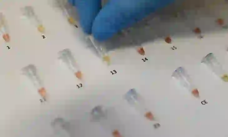 OBSH: Tuberkulozi, sëmundja më vdekjeprurëre në botë! Shifër rekord infektimesh