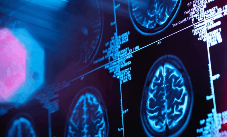 Pesë fazat e zhvillimit të trurit. Çfarë ndodh nga fëmijëria deri në pleqëri?!