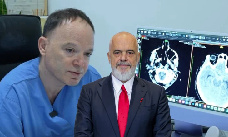 Rama vlerëson suksesin e neurokirurgëve të QSUT: Një tjetër histori suksesi