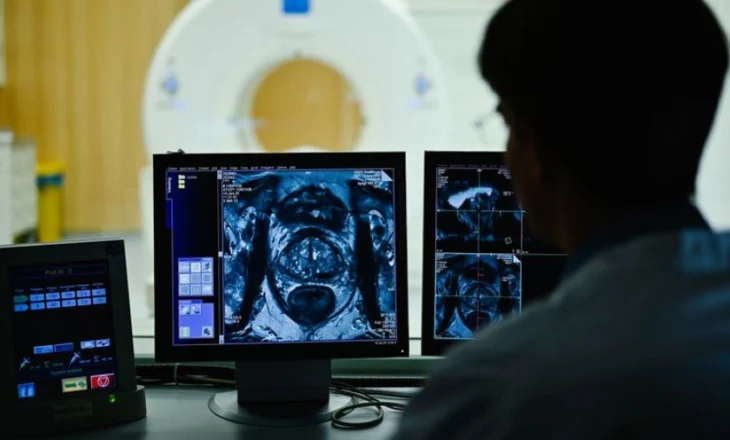 Shkencëtarët bëjnë një zbulim ‘të papritur’ për trajtimin e kancerit