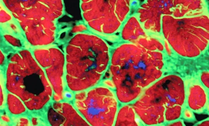 Studimi: Një gjen miqësor ndaj zemrës ndihmon në riparimin e saj pas një ataku