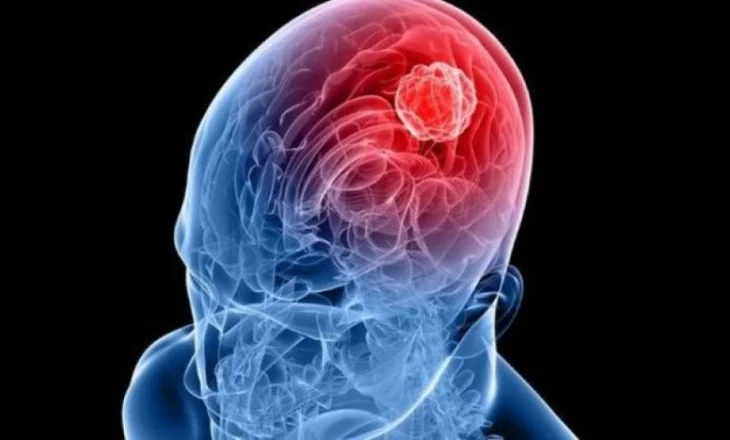 Truri ‘fiket’ papritur para gjumit