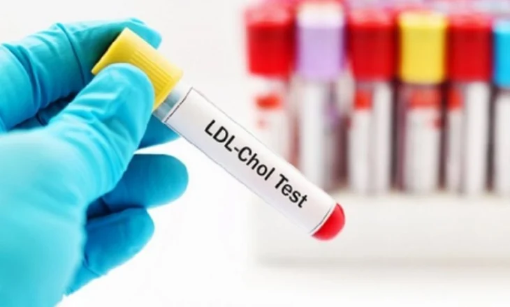 Zbulohet ilaçi i ri i cili ul ndjeshëm LDL (kolesterolin e keq)