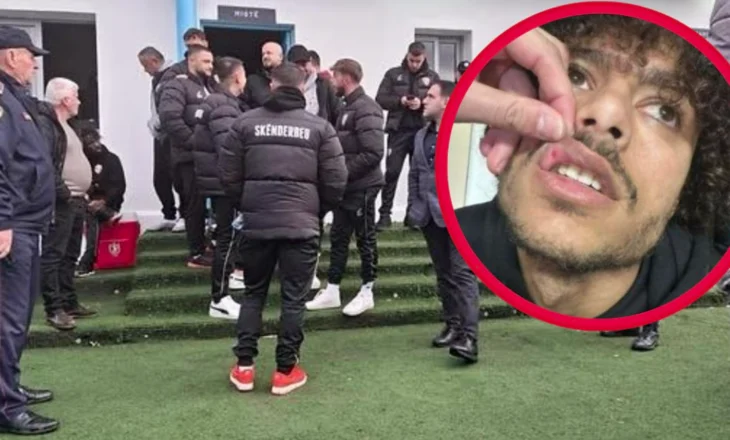 Dhunuan kundërshtarët para ndeshjes në Fushë Krujë, nën hetim tre futbollistët e skuadrës “Iliria”