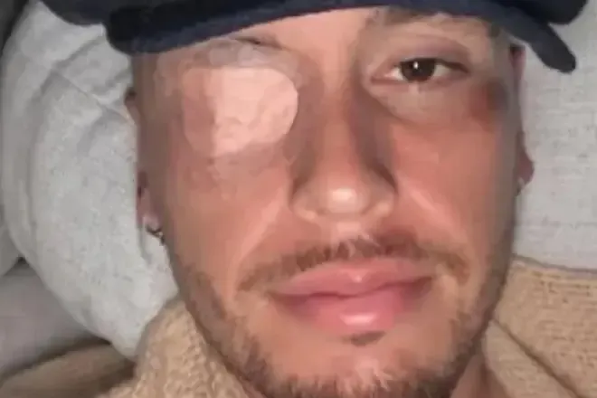 Lucas Ocampos pëson paralizë faciale, duhet të qëndrojë dy javë pushim absolut