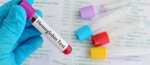 Nivelet normale të hemoglobinës/ Si t’i kuptoni dhe kur duhet të shqetësoheni?